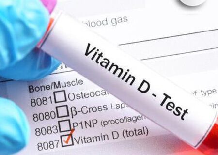 عوارض مصرف بیش از حد ویتامین D را بدانید
