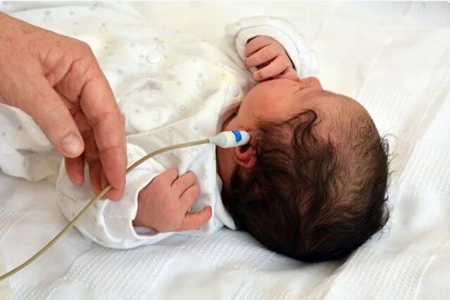 سالانه ۵۰۰۰ نوزاد کم شنوا در ایران متولد می شود