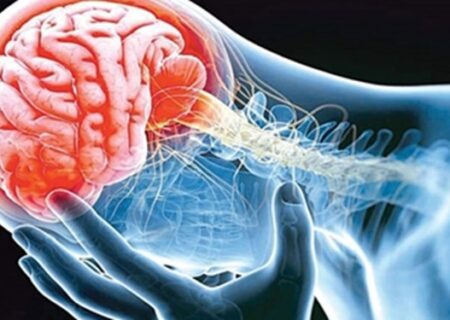 شناسایی سلول‌ های مغزی مرتبط با بیماری پارکینسون