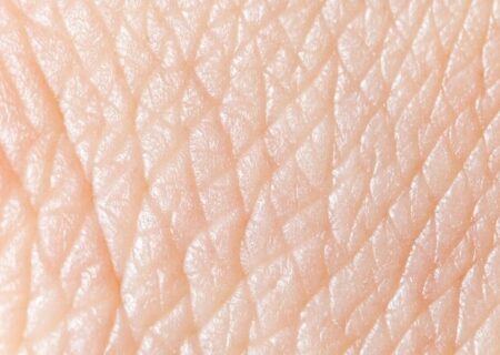 تشخیص بیماری پارکینسون از بوی پوست با بینی الکترونیکی
