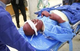 مصدومان چهارشنبه سوری در آذربایجان غربی ۳۱۱ نفر رسید