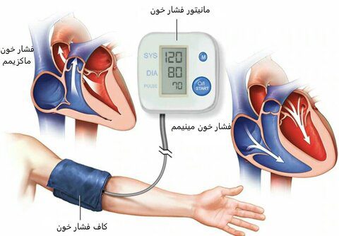 اندازه گیری فشار خون با استفاده از تلفن همراه