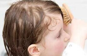 ریزش مو در زنان می تواند نشانه مشکلات بزرگ تر سلامت باشد