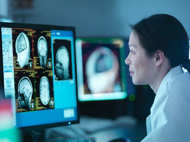 تشخیص بیماری آلزایمر با اسکن مغز