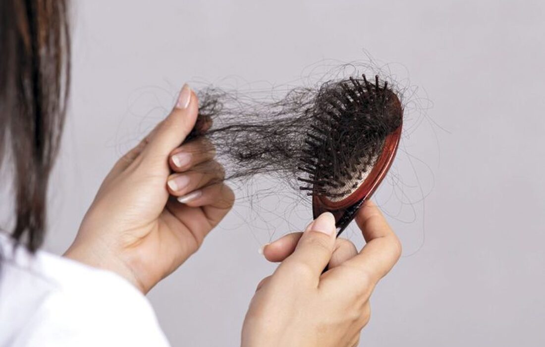 ۲۰ دلیل اصلی ریزش موهای شما چیست؟