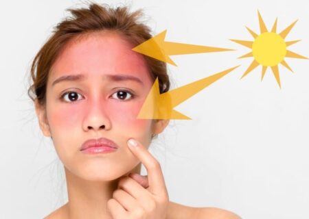 برای جلوگیری از آفتاب سوختگی چه بخوریم؟