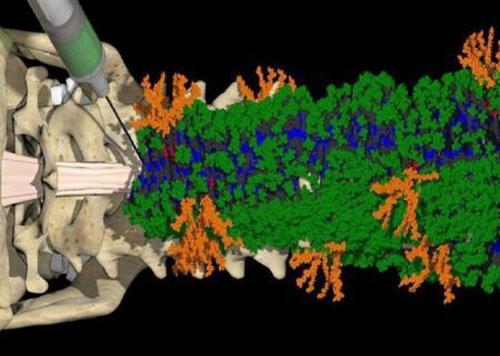 یک درمان تزریقی برای ترمیم آسیب‌ های نخاعی