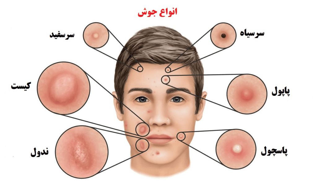 انواع جوش