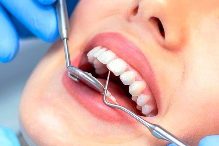 برخی مشکلات دندانی با بیماری های دیگر مرتبط هستند