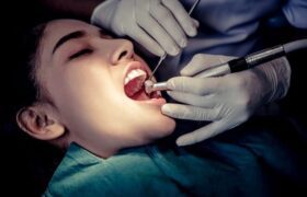 دندانپزشکی و جراحی عمومی بیشترین پرونده قصور پزشکی در سال ۱۴۰۰