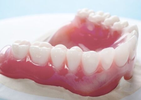 روش شستشو و جرمگیری دندان مصنوعی