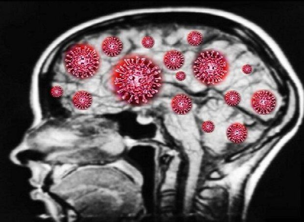اسکن‌ها تغییرات مغزی در مبتلایان کووید طولانی را نشان می‌دهند