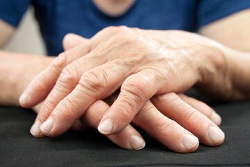 داروی کنترل‌کننده آرتروز دست و دردهای ناشی از آن