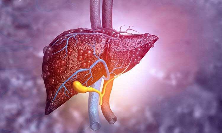 این علائم می گوید شما کبد چرب دارید