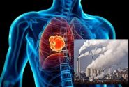 ارتباط هوای آلوده با سرطان ریه