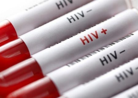 آخرین وضعیت HIV در کشور