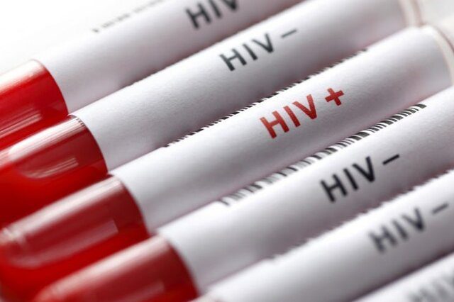 آخرین وضعیت HIV در کشور