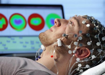 نقش دستگاه EEG در تشخیص اختلالات روانی