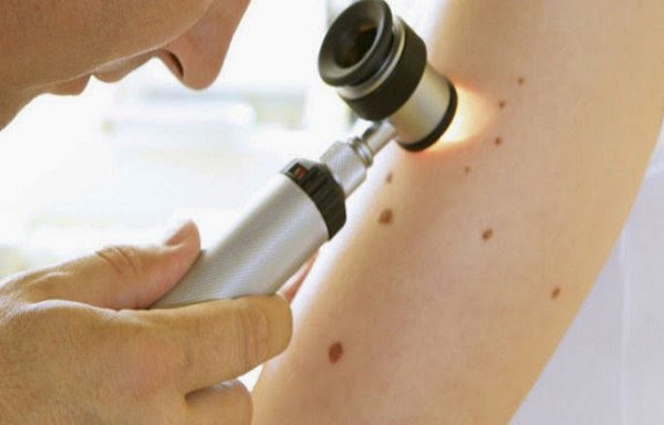 نصف شدن خطر مرگ ناشی از سرطان پوست با فناوری mRNA