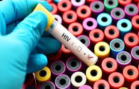 روند پیری در زنان مبتلا به HIV سریع‌تر اتفاق می‌افتد