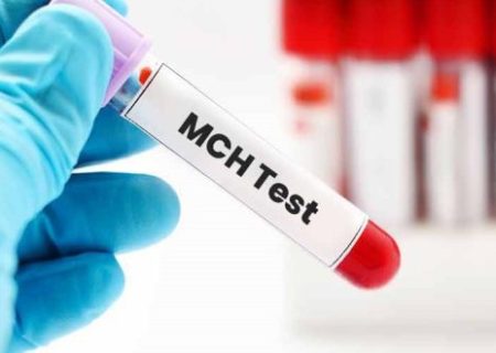 MCH در آزمایش خون و هر آنچه که باید درباره‌ آن بدانیم!