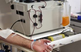 جداسازی پلاسما از خون در عرض نیم ساعت و با دقت بالا