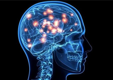 تجمع آهن در مغز پس از ضربه مغزی