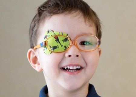 «تنبلی چشم» شایع‌ترین علت نابینایی یک چشمی/ توصیه‌هایی به والدین برای درمان