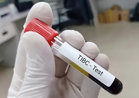 تفسیر آزمایش TIBC و عوارض پایین یا بالا بودن آن در خون