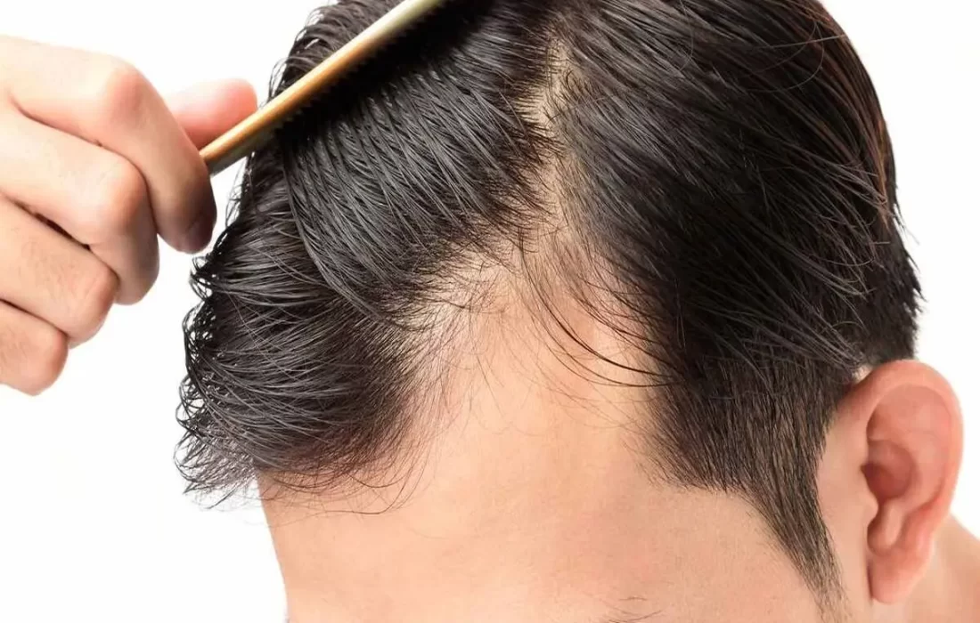 چگونه از آسیب‌دیدگی موها پیشگیری کنیم؟