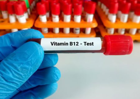 چه زمانی باید آزمایش ویتامین B12 یا کوبالامین را انجام دهیم؟
