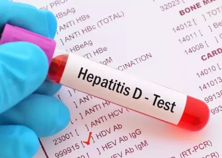 هپاتیت D چیست و چه علائمی دارد؟