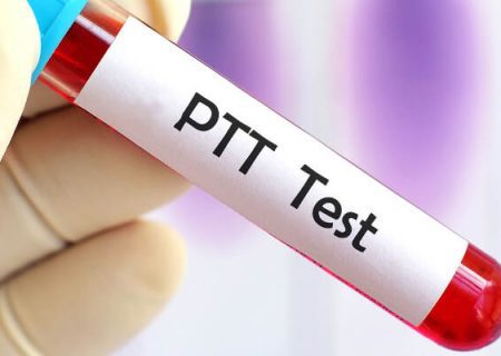 آزمایش PTT چیست و چه زمانی تجویز می‌شود؟
