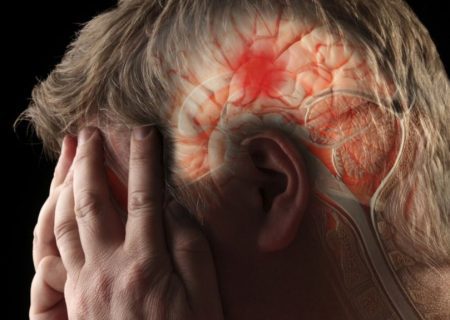 علائم سکته مغزی چیست؟ نشانه‌هایی که باید به آنها توجه کرد