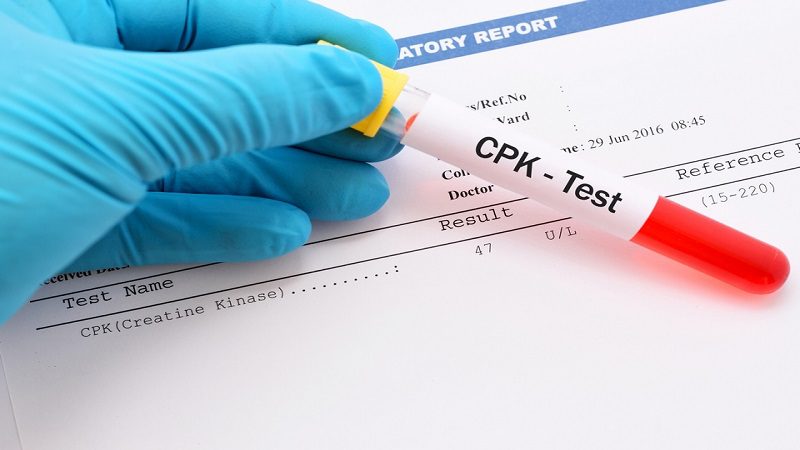 آزمایش cpk (کراتین فسفوکیناز) چیست؟