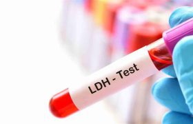 آزمایش LDH چیست و چه کاربردی دارد؟