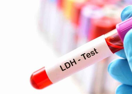 آزمایش LDH چیست و چه کاربردی دارد؟