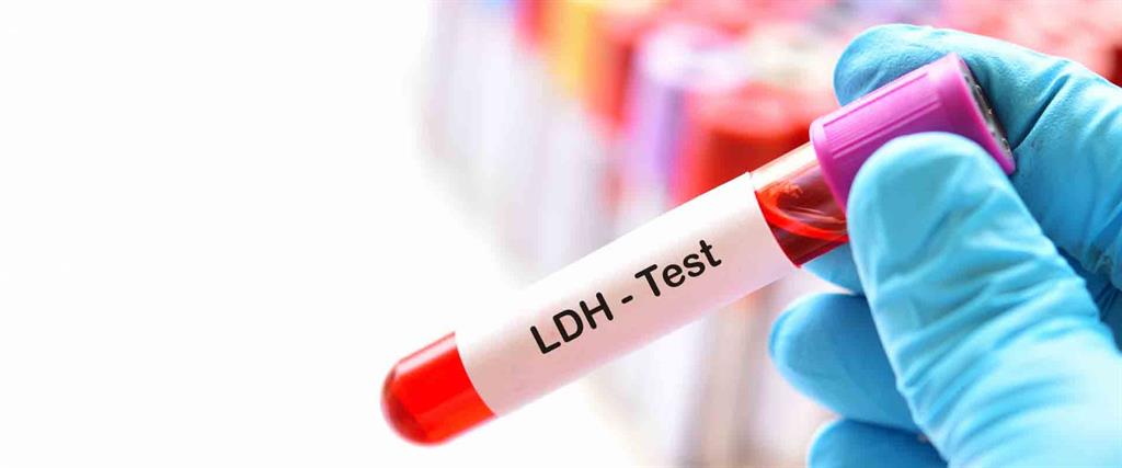 آزمایش LDH چیست و چه کاربردی دارد؟