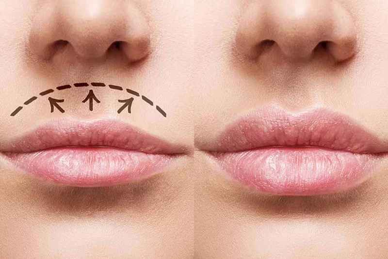 سانترال لب چیست و چه کاربردی دارد؟
