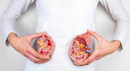 علائم سنگ کلیه در زنان چیست؟