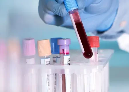 آماده شدن نتیجه آزمایش خون چقدر زمان می‌برد؟