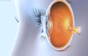 نوار عصب چشم چیست؟