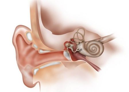 اتواسکلروز (Otosclerosis) چیست؟ علت، علائم و راه کارهای درمان آن