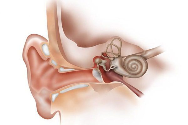 اتواسکلروز (Otosclerosis) چیست؟ علت، علائم و راه کارهای درمان آن
