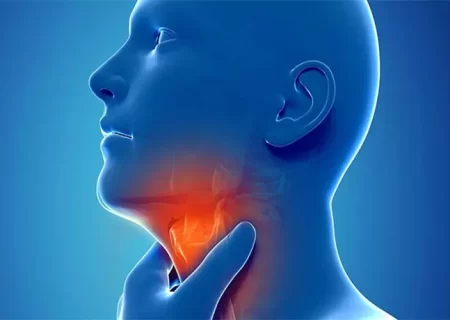 لارنژیت رفلاکس؛ درباره التهاب حنجره ناشی از رفلاکس اسید چه می‌دانید؟