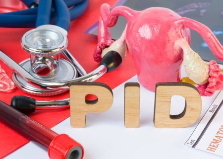 التهاب لگن (PID)؛ علائم، علائم، تشخیص و درمان
