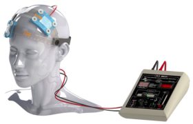 آیا درمان افسردگی با دستگاه TDCS ممکن است؟